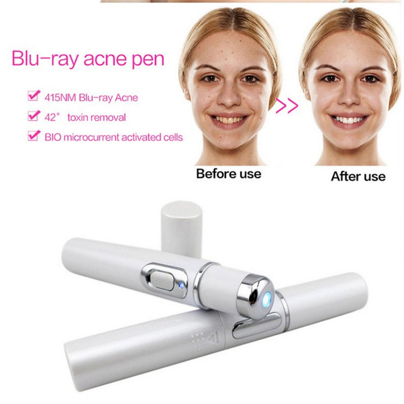 Acne Laser Pen