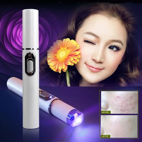 Acne Laser Pen