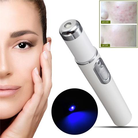 Acne Laser Pen